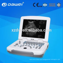 Full-Digital 96 Element konvexen Laptop Ultraschall-Diagnose-Maschine und Laptop Ultraschall DW-500